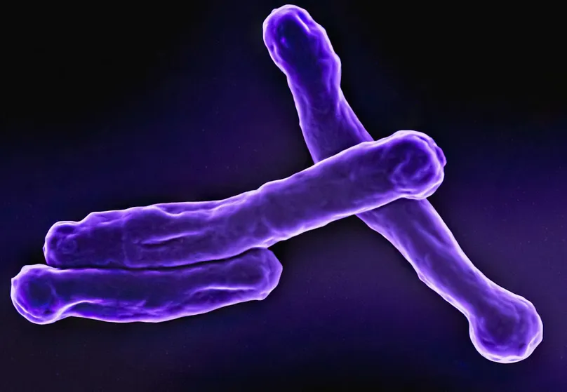 TB bacteria