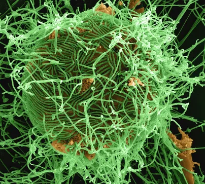 Ebola virus - Photo by National Institute of Allergy and Infectious Diseases